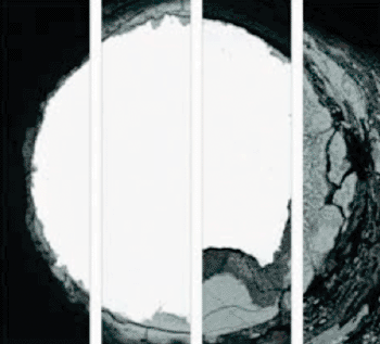 Image: A composite image of zinc degradation in a rat artery (Photo courtesy of Michigan Technological University). Image: A composite image of zinc degradation in a rat artery (Photo courtesy of Michigan Technological University).